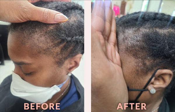 Sérum fortifiant pour les tempes - 118 ml